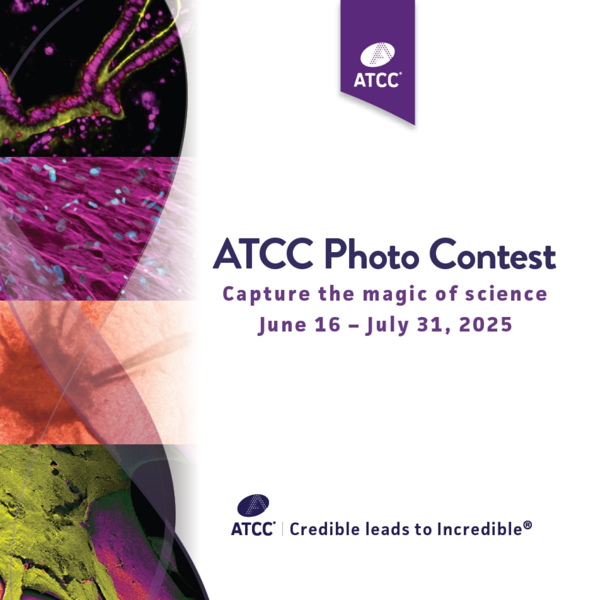 officialatcc's tweet image. Showcase your striking research images using ATCC cell lines or microbial strains. Submit now through July 31, 2025, for a chance to win in one of two categories: Most Popular or Excellence in Research. Six winners will be awarded!
Learn more: ow.ly/OMAT50WjSRE