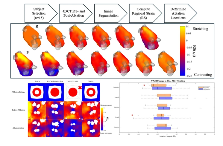 JICE_EP's tweet image. 🚨New #FreeRead Article in
@JICE_EP
Impact of Ablation on Regional Strain from 4D Computed Tomography in the Left Atrium
🧐📖 rdcu.be/evQMy
by Noah Mehringer, Lauren Severance, Aaron Park, Gordon Ho & Elliot McVeigh
#EPeeps