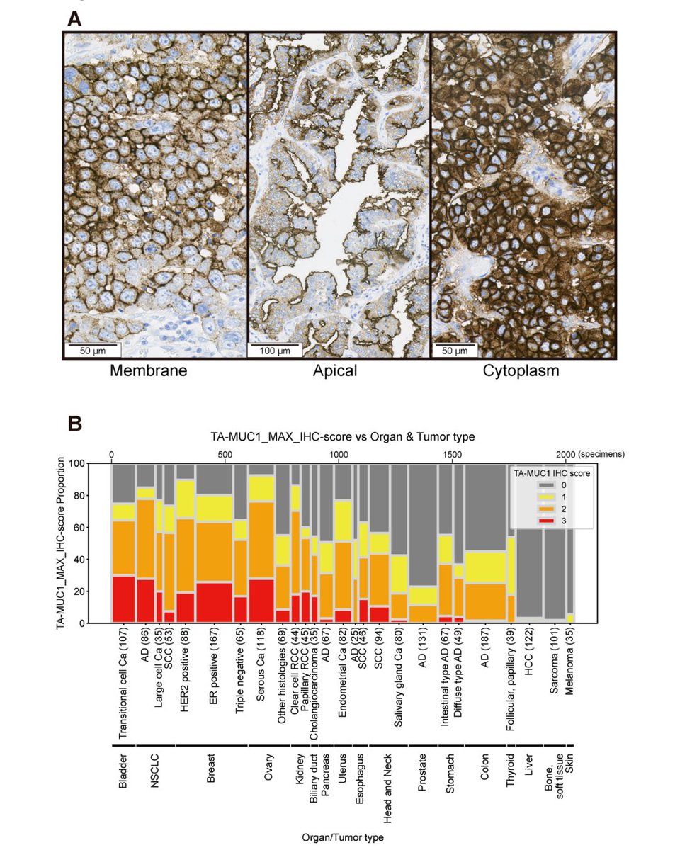 MCT_AACR's tweet image. #OnlineFirst: DS-3939a: A TA-MUC1-directed #AntibodyDrugConjugate with Broad Anti-Tumor Activity. doi.org/10.1158/1535-7…
#MUC1 #FirstDisclosure #OpenAccess
