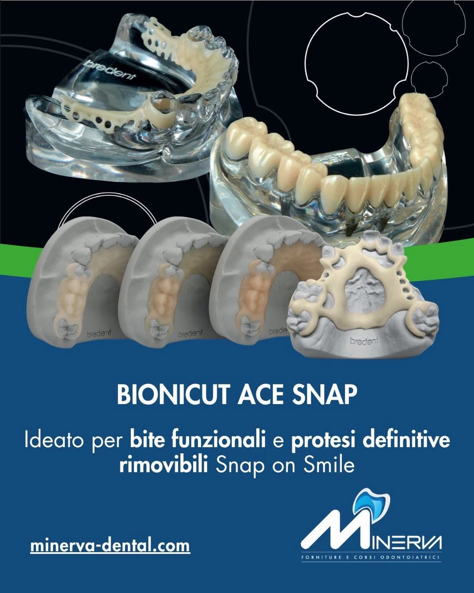 minerva_dental's tweet image. 🎯  BioniCut Snap: un disco di materiale polimerico pensato per i tuoi lavori più esigenti in ambito CAD/CAM.

#BioniCutSnap #Bredent #Odontotecnici #CADCAM #SnapOn #TecnicaDentale #minervadental #minerva #odontotecnico