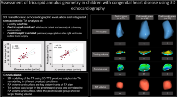 JuanSanchisFor's tweet image. 3D modelling of the tricuspid annulus in congenital heart diseases using 3D-TTE provides insights into tricuspid annulus remodelling in different right ventricular overload conditions. Read this article published in @RevEspCardiol by @drhadeed77
revespcardiol.org/en-assessment-…