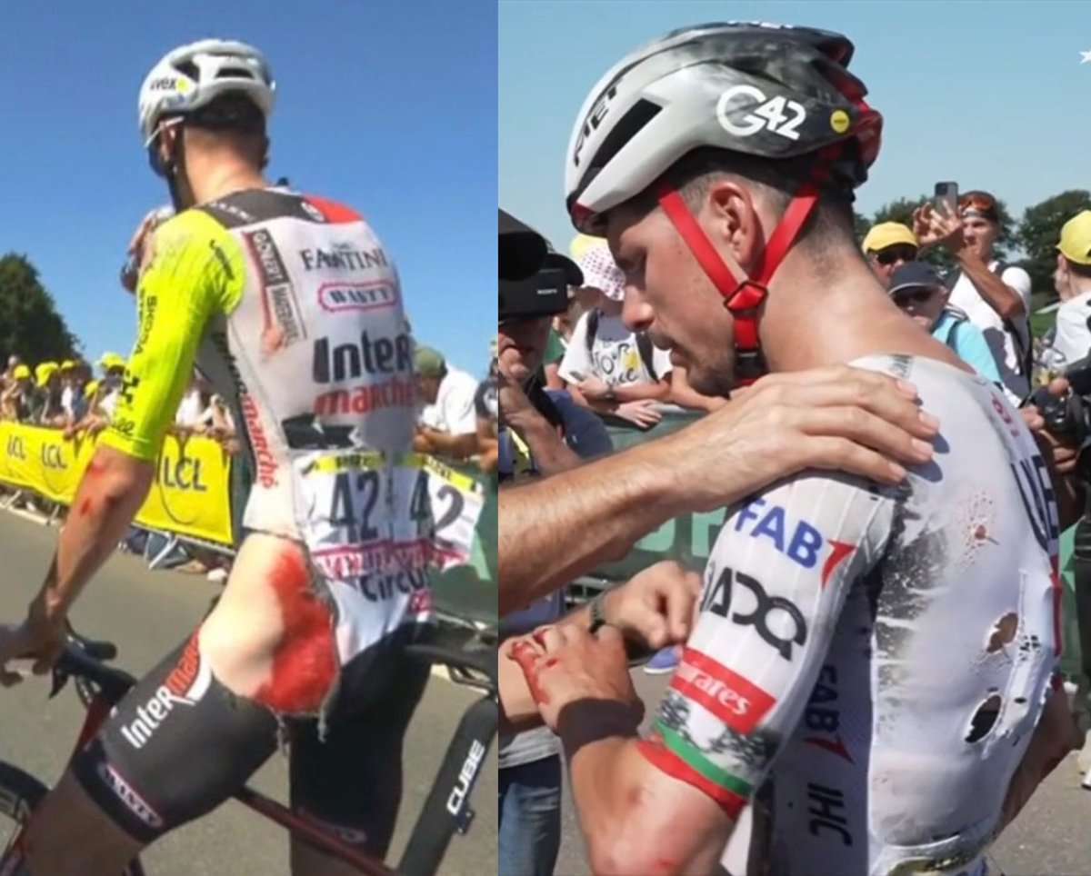 lucxsronald's tweet photo. Both Louis Barre and Joao Almeida finished the stage after the crash⦠good news. #TDF2025 https://t.co/afWoKm1K7m