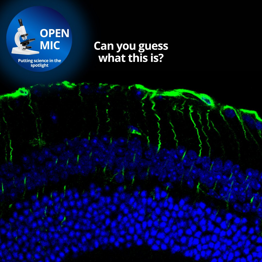 UTSWMedCenter's tweet image. (1/2) Welcome to another #OpenMic, where we magnify the work of #UTSouthwestern's brilliant researchers. This month, please welcome Katherine Wert, Ph.D., whose work focuses on the retina, or the light-sensitive layer at the back of the eye. @WertLaboratory