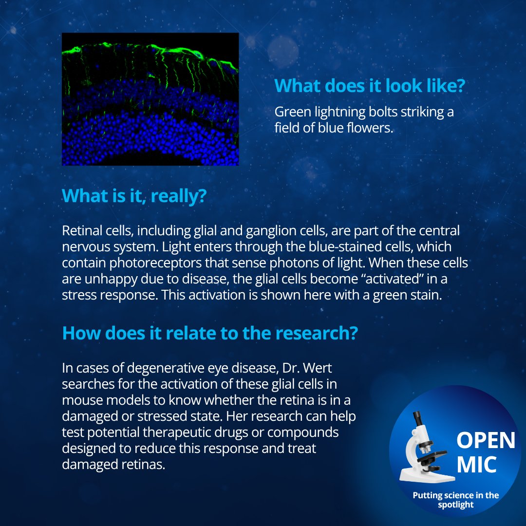 UTSWMedCenter's tweet image. (1/2) Welcome to another #OpenMic, where we magnify the work of #UTSouthwestern's brilliant researchers. This month, please welcome Katherine Wert, Ph.D., whose work focuses on the retina, or the light-sensitive layer at the back of the eye. @WertLaboratory
