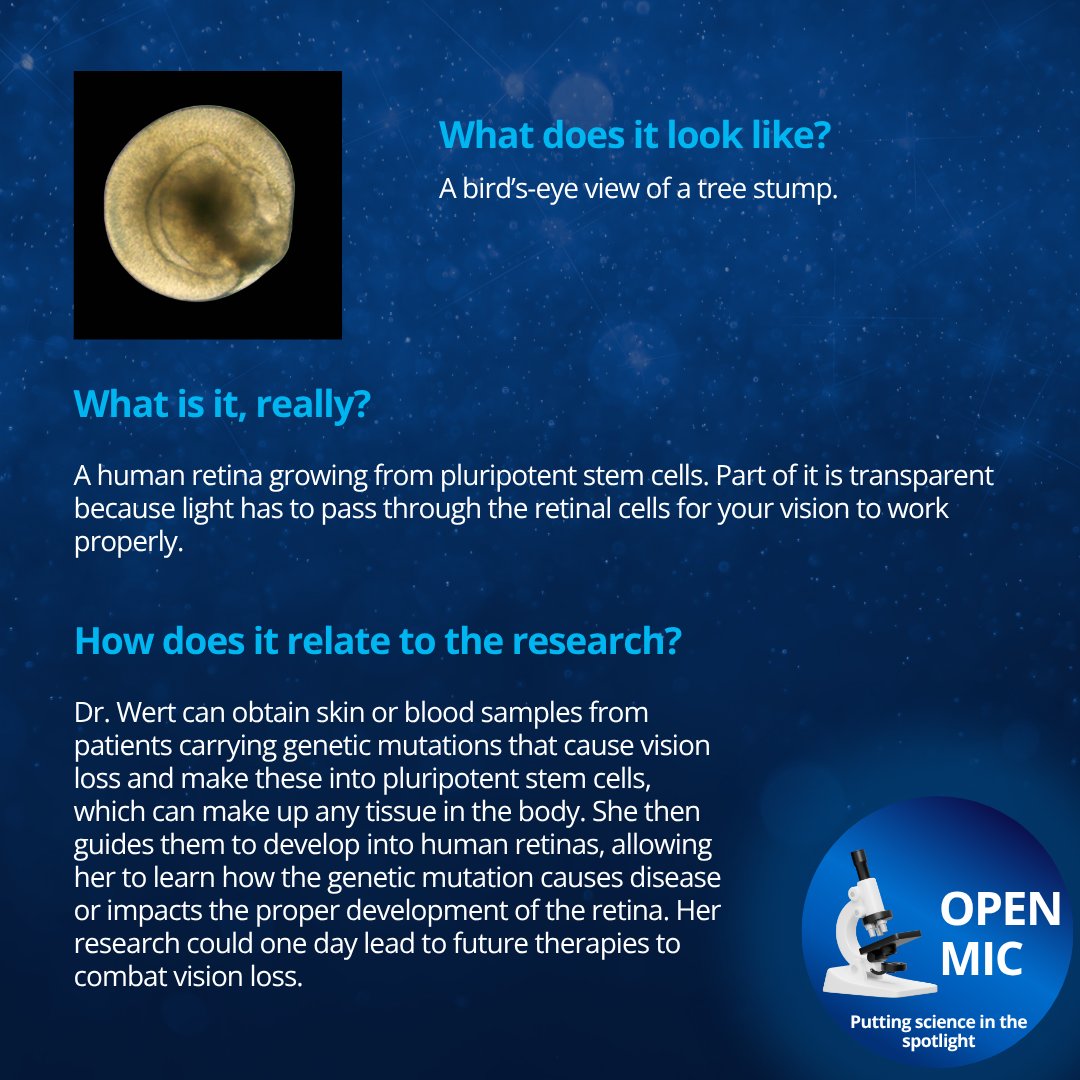 UTSWMedCenter's tweet image. (1/2) Welcome to another #OpenMic, where we magnify the work of #UTSouthwestern's brilliant researchers. This month, please welcome Katherine Wert, Ph.D., whose work focuses on the retina, or the light-sensitive layer at the back of the eye. @WertLaboratory