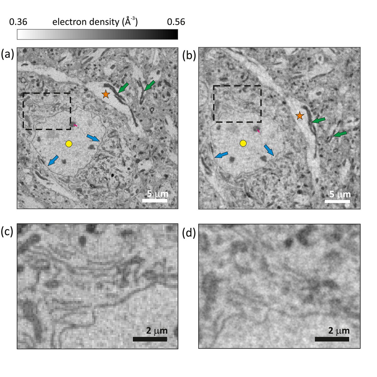 Optica Publishing Group (@opticapubsgroup) on Twitter photo An Editors' Pick via #OPG_OpEx: Experimental comparison of X-ray ptychographic and holographic nanotomography of metal-stained neuronal tissue bit.ly/3GyOl9F #XRayNanotomagraphy #SpatialResolution <a href="/psich_en/">PSI Paul Scherrer Institut</a> An Editors' Pick via #OPG_OpEx: Experimental comparison of X-ray ptychographic and holographic nanotomography of metal-stained neuronal tissue bit.ly/3GyOl9F #XRayNanotomagraphy #SpatialResolution <a href="/psich_en/">PSI Paul Scherrer Institut</a>