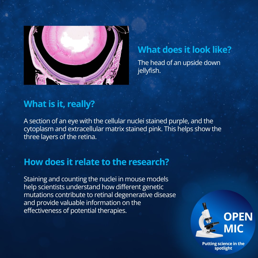 UTSWMedCenter's tweet image. (2/2) “My lab is interested in the photoreceptor cells, which first sense light and then kick off the signaling cascade. If you lose any portion of these, you lose visual response. We want to be able to replace these cells or find a way to keep them around.” -@WertLaboratory