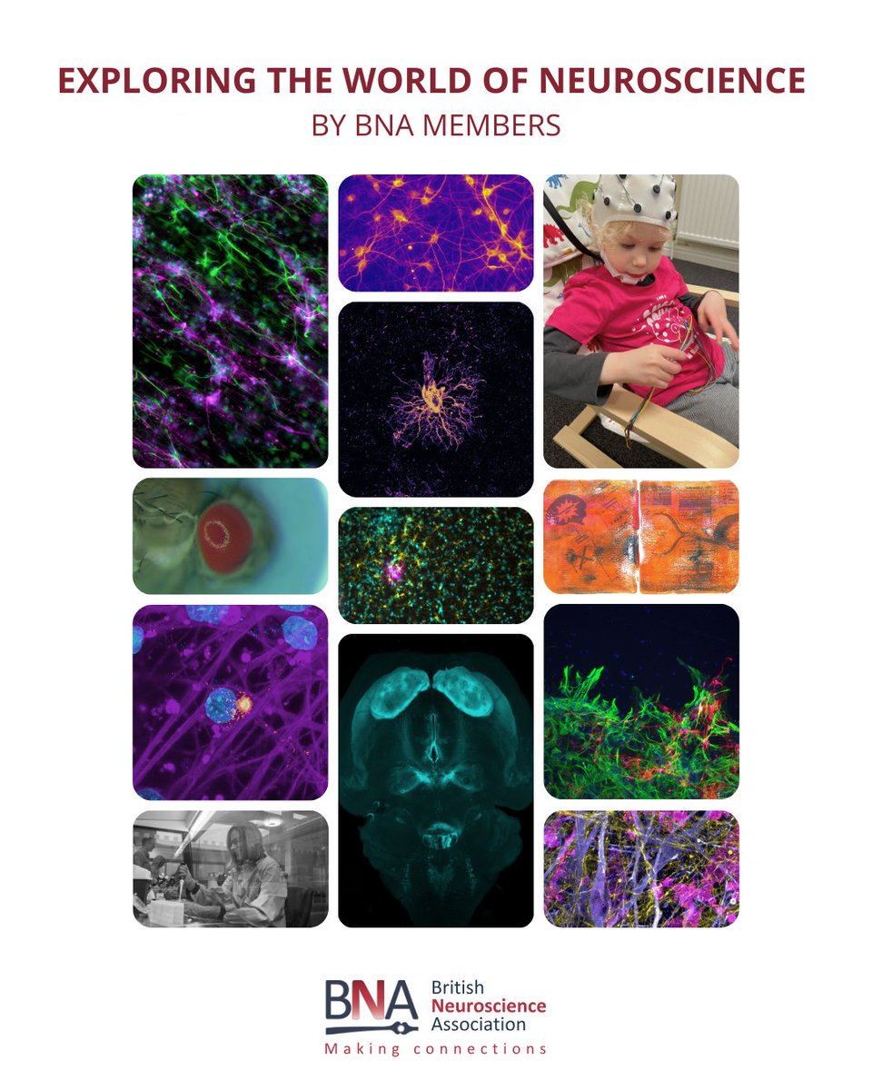 BritishNeuro's tweet image. What does everyday #Neuroscience look like? We asked our members to show us, and the results were nothing short of inspiring.
#ScienceIsBeautiful #EverydayNeuroscience
#ThroughTheMicroscope
bna.org.uk/resource/explo…
