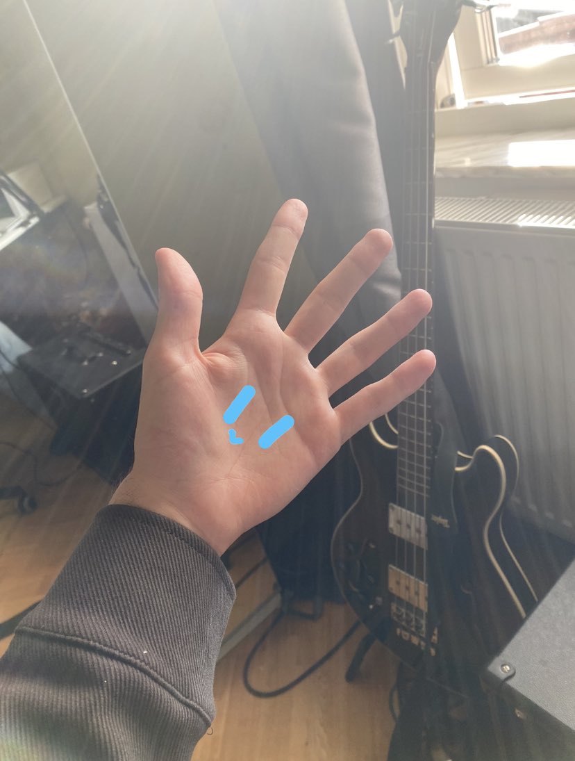 BlueGoesFast's tweet image. Turned 19 woo !!

hand getting wrinkly and old………..