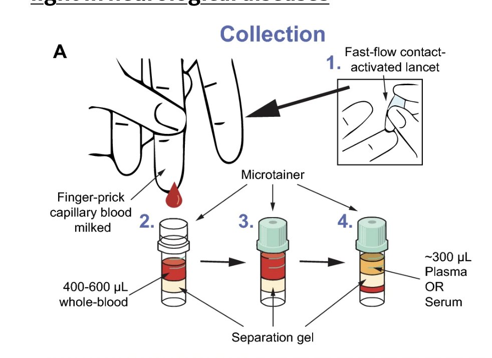 IJMSC (@ijmsctweets) on Twitter photo "Using #NfL concentrations from capillary blood, we replicated previously published disease group differences measured in venous blood. This data supports our #FingerPrick approach for remote collection and quantification of NfL." J of Neuro doi.org/10.1007/s00415…
<a href="/UCLHD/">UCL Huntington’s Disease Centre</a> <a href="/UCLIoN/">UCL Queen Square Institute of Neurology</a> "Using #NfL concentrations from capillary blood, we replicated previously published disease group differences measured in venous blood. This data supports our #FingerPrick approach for remote collection and quantification of NfL." J of Neuro doi.org/10.1007/s00415…
<a href="/UCLHD/">UCL Huntington’s Disease Centre</a> <a href="/UCLIoN/">UCL Queen Square Institute of Neurology</a>