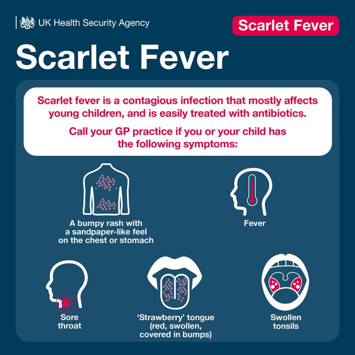 Sore throat, fever + a rash? It could be scarlet fever 🤒
Highly contagious but treatable – know the signs:
👉 nhs.uk/conditions/sca…

#ScarletFever #PublicHealth #ChildHealth
