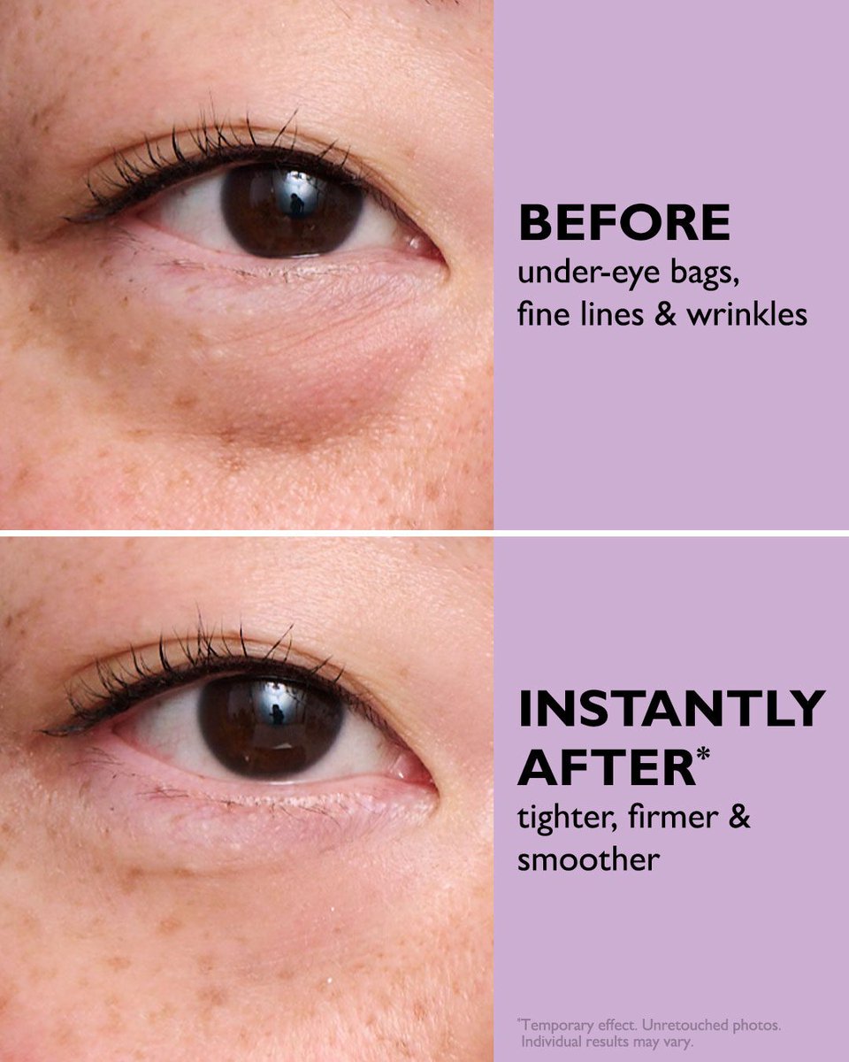 PTRskin's tweet photo. Everyone's favorite viral eye tightener, now in an easy-wear formula! https://t.co/u5V5kpgEdC