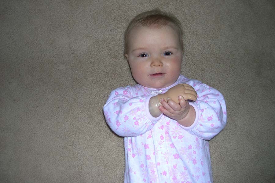 We welcome children of all ages and their parents to meet with us, either over video chat or in person, to learn more about prosthetic options.
armdynamics.com/upper-limb-lib…