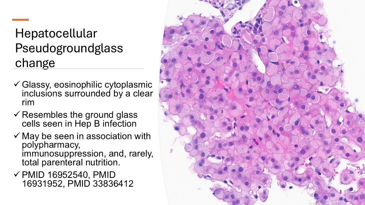 MarylandPath's tweet image. #LiverPath
