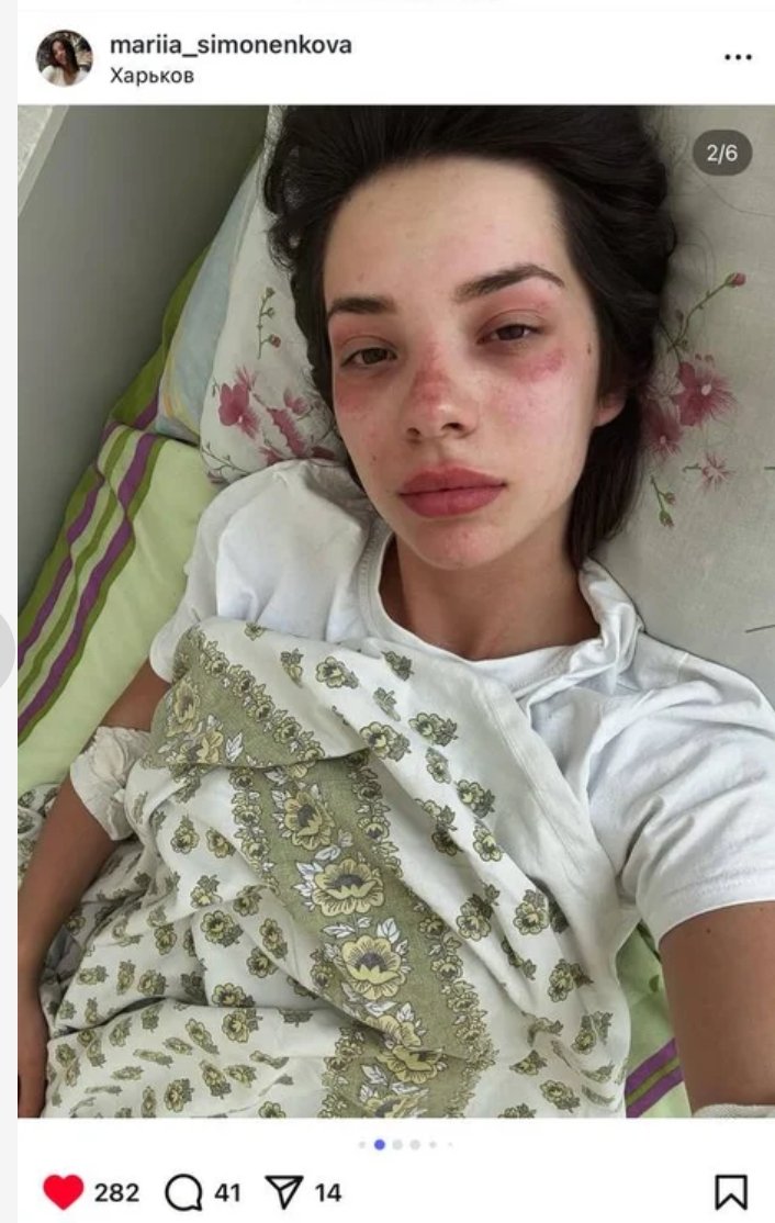 'Maria didn't hear the air raid siren. She was fast asleep in her eighth-floor apartment in a Kharkiv high-rise. But the sound of a "Shahed" drone woke her up.

"I realized it was going to hit either my building or the one next door. Instinctively, I curled up into a fetal