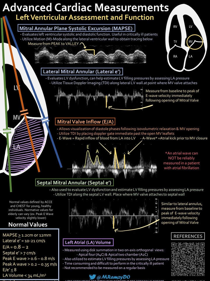 🔴Advanced Cardiac Measurement ⤵️ Echocardiography

🔹Quantitative Measurements of #cardiac function using #POCUS.

🔹Dr. Mark Ramzy . ED/ICM Doc
 #Cardiology #FOAMed #MedEd #medstudent #paramedic #Cardiology #CardioEd #medtwitter #meded #CardioTwitter #cardiotwiteros