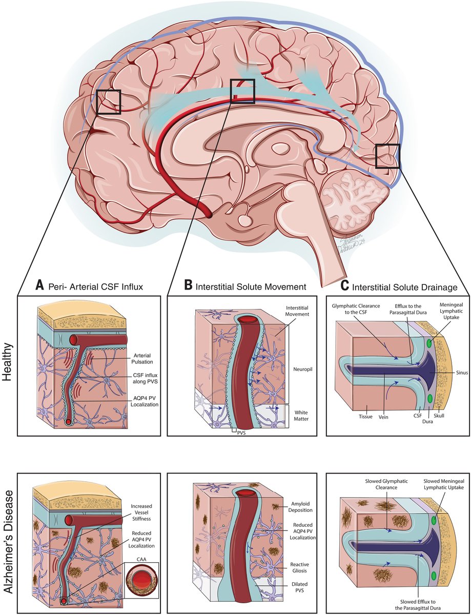 In a new #ScienceReview, researchers provide a critical evaluation of research linking glymphatic dysfunction with Alzheimer’s disease. scim.ag/44Hh18I