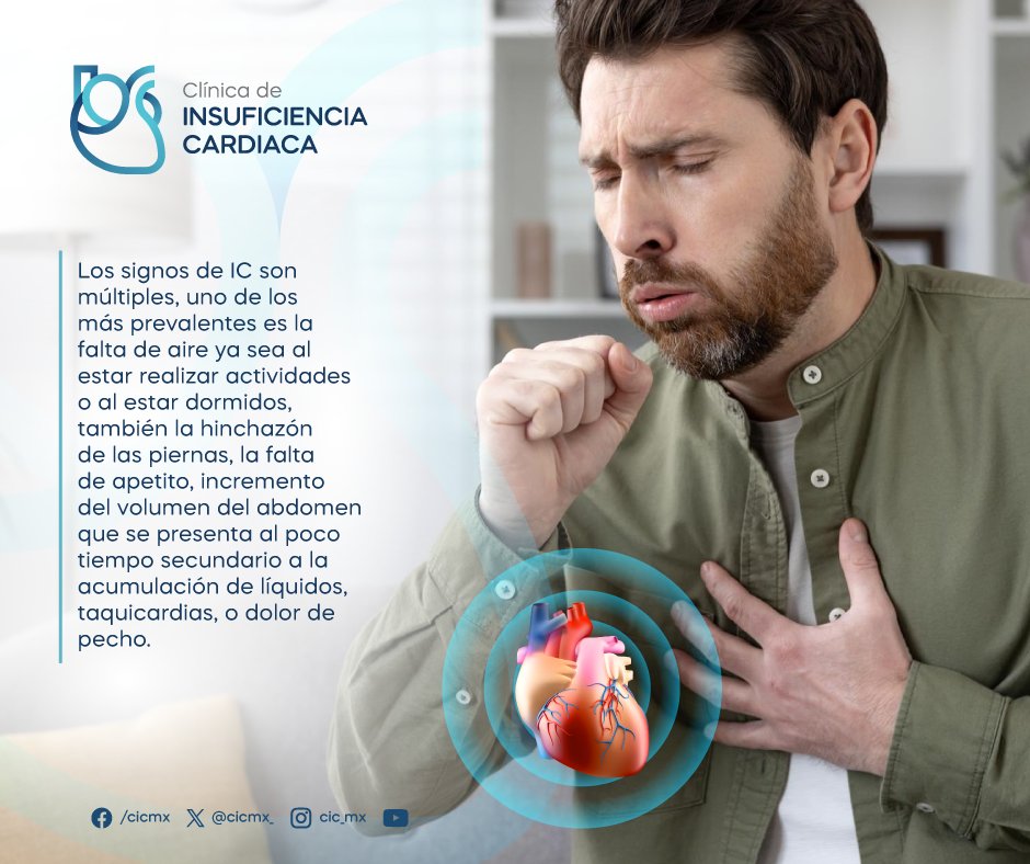 #Conocimiento_CIC
¿Sabes cuáles son los síntomas de Insuficiencia Cardíaca? 
👉¿Necesitas una valoración médica? Clínica especializada en Insuficiencia Cardíaca. 
☎ 33 3621 0808
📱 Whats 3316031390
📍 Blvd. Puerta De Hierro 5090 Piso 1, S/N Col. Puerta de Hierro, Zapopan, Jal.