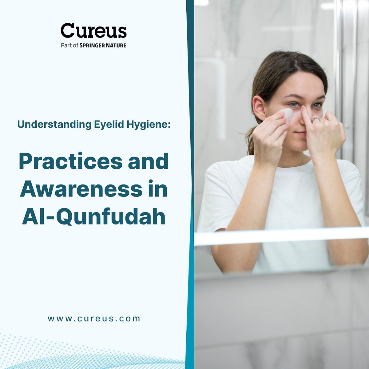 How Well Do We Care for Our Eyelids? A Study from Saudi Arabia

Explore the awareness and habits of eyelid hygiene in Al-Qunfudah’s population and their implications for eye health.

Read more: hubs.la/Q03wYR960

#EyeCare #Hygiene #HealthStudy #SaudiArabia #Cureus