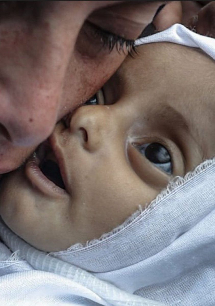 Çocukluğunu yaşayamayan bu çocuğun vebalini taşıya bilecek misin ey Müslüman?

  #HanzalaReturnsForGaza
Hanzala Gazze için dönüyor