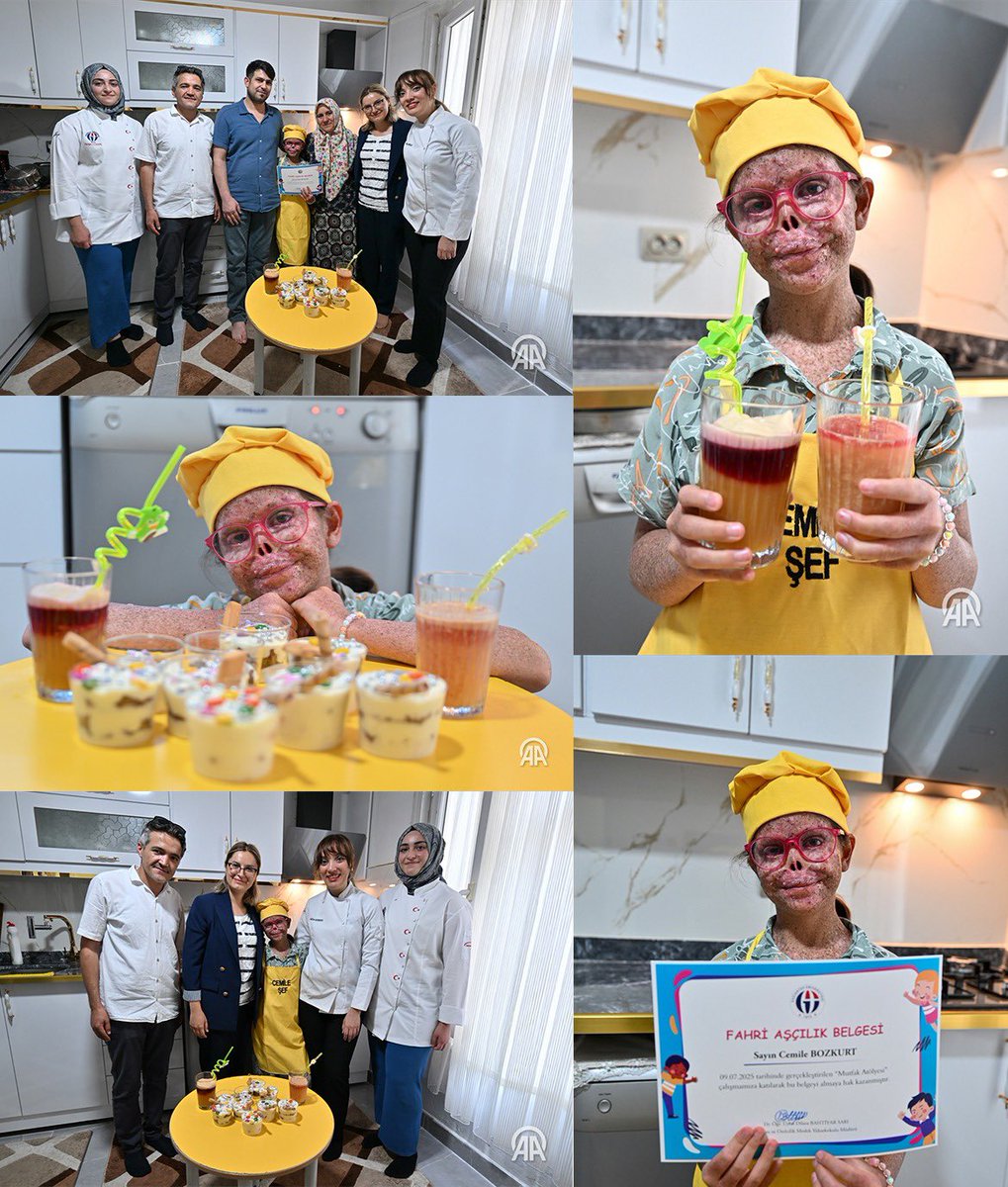 Minik Cemile’nin aşçılık hayali gerçek oldu. 👩‍🍳

#GaziantepÜniversitesi Turizm ve Otelcilik MYO ekibimiz, XP hastası Cemile’yi evinde ziyaret etti, önlük hediye edip birlikte tatlı yaptı. Küçük bir dokunuş, büyük bir mutluluk.

Emeği geçen hocalarımıza teşekkür ediyorum.

#Gaün