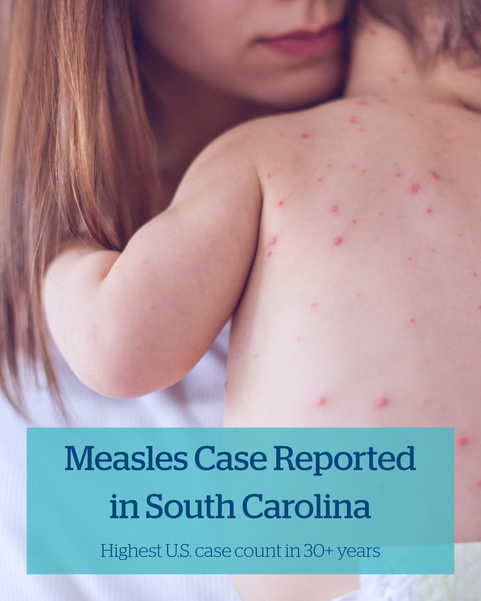 The first measles case of 2025 has been confirmed in South Carolina, as the U.S. sees its highest case count in over 30 years.

Dr. Stephen Thacker from MUSC Children’s Health says vaccination is our best defense.

Read more: musc.co/3TUqYe1