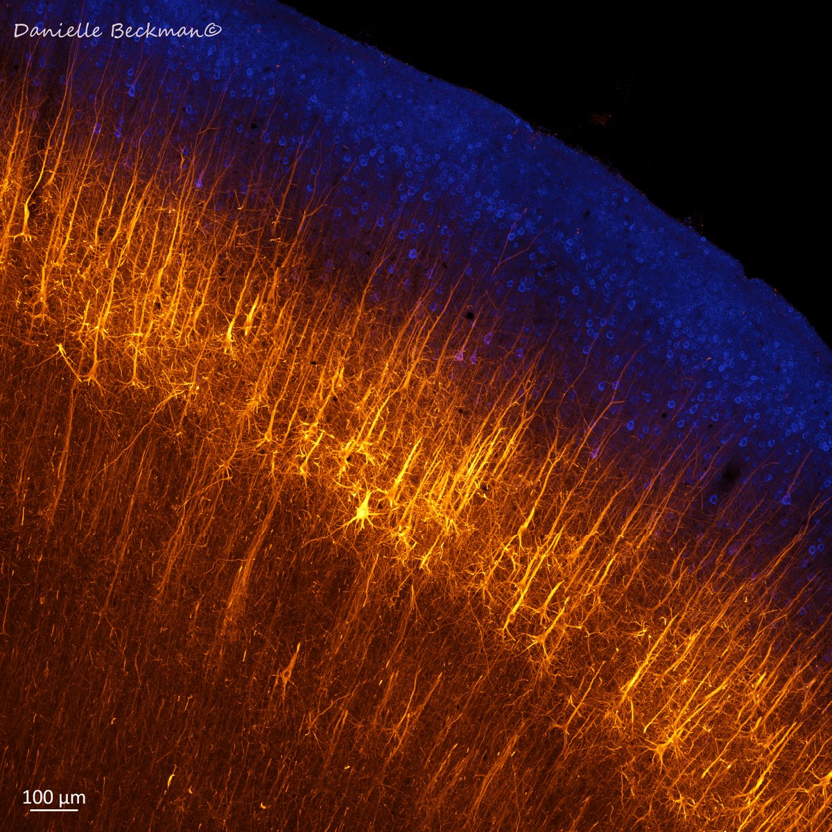 This is who you REALLY are. You are not a reflection in a mirror. There are no liposuction or fillers to prevent your neurons from showing your actual age. 
Support basic scientific research so that one day we may learn how to grow new neurons in the brain. 
#FluorescenceFriday