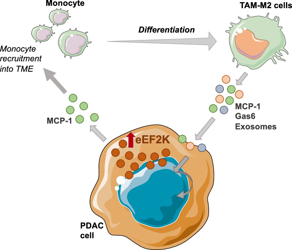 ExtracellMatrix's tweet image. Dr. @Didem_Karakas and a team in Dr. Bulent Ozpolat's lab at @MDAndersonNews found that the expression of eEF2K is associated with shorter patient survival and that eEF2K signaling is critical for the #PDAC tumor growth.
go.nature.com/4lKudQT