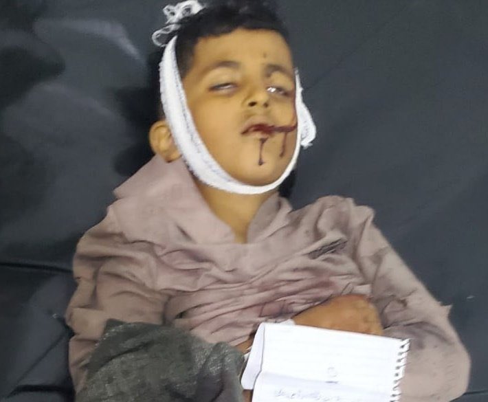 لو ارتُكبت هذه الجريمة البشعة في #تعز على يد جماعة الحو///ثي ، لكانت شاشات #الحدث الأصغر والمواقع تضجُّ بها الآن.

هذا نفاق  لا نقبله !

علينا أن ندين كل جريمةٍ على قدم المساواة، ونحاسب المجرمين دون مواربة أو تمييز.

#اطفال_تعز