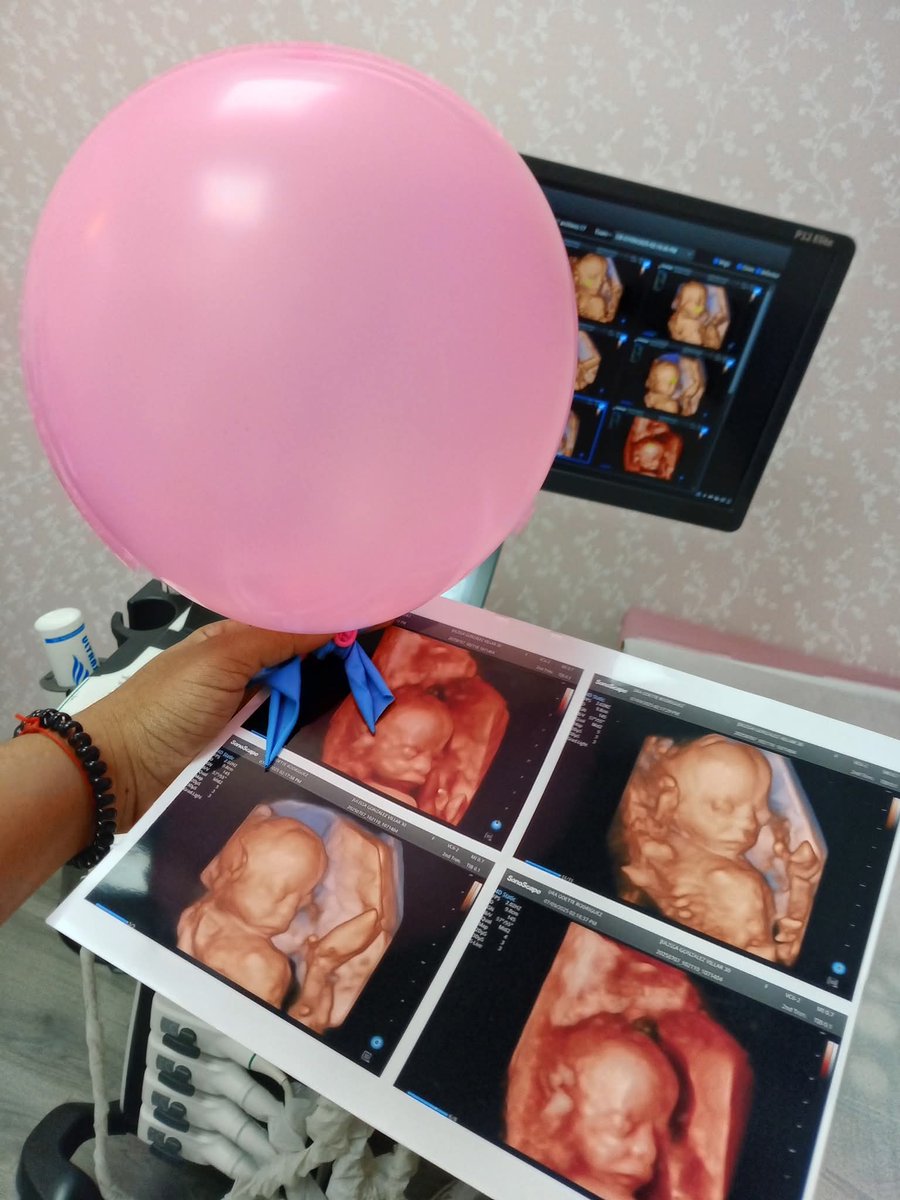 officialjulig's tweet photo. Gracias doctora, ya tenemos la primera foto pa’ el álbum familiar 📸  💕 #Sophiaisabelle https://t.co/NvWazXvU21
