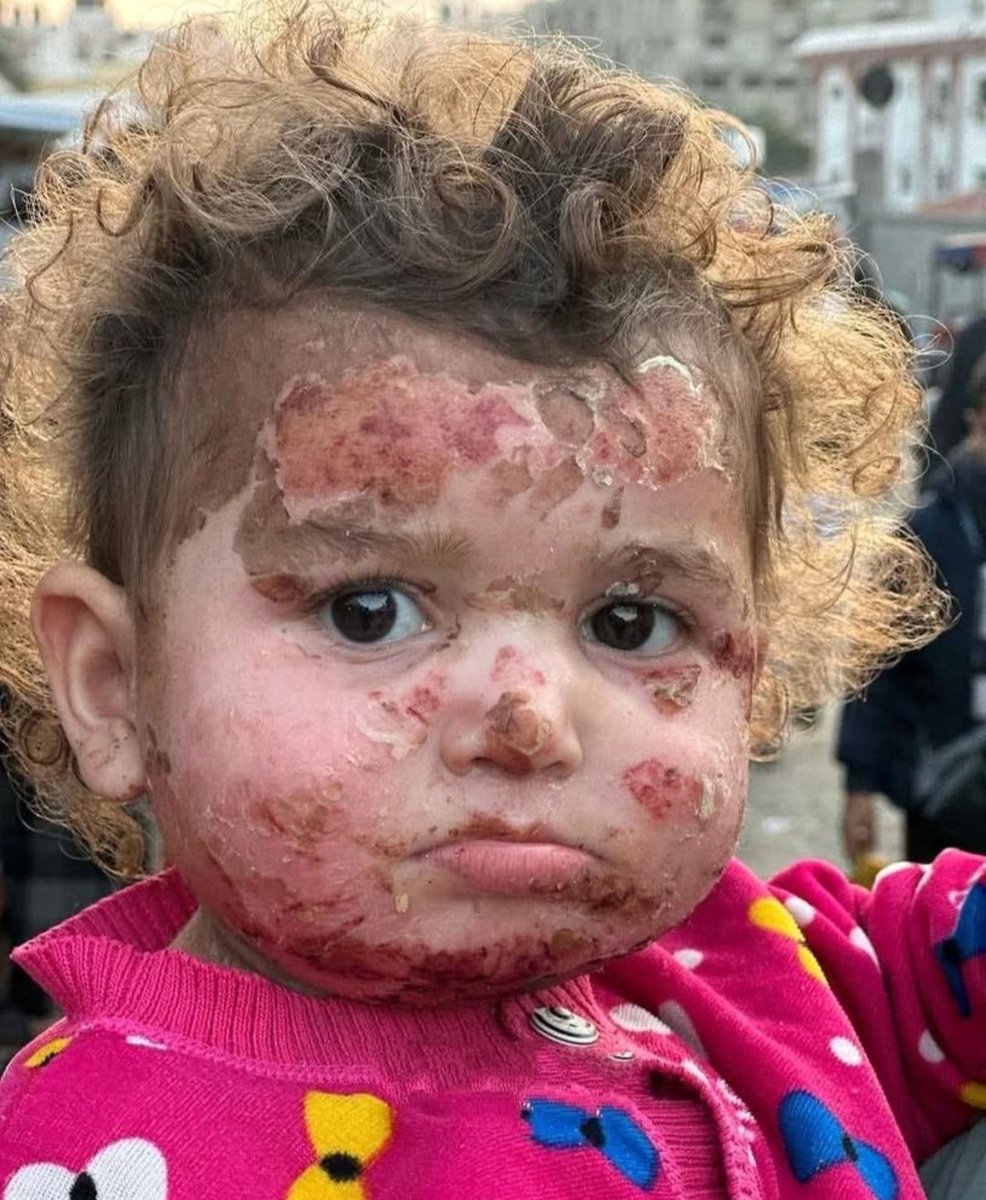 Gazze'de katliamlar devam ediyor