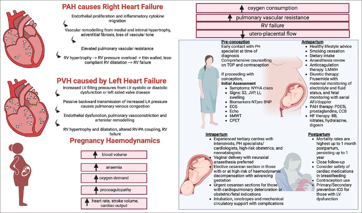 Pulmonary Hypertension has long been one of the riskiest heart conditions in pregnancy — but that’s changing.

A review paper co-authored by our #NUHCS cardiologists highlights how advances in care are improving outcomes &amp; lowering maternal mortality.

journals.lww.com/smj/fulltext/2…