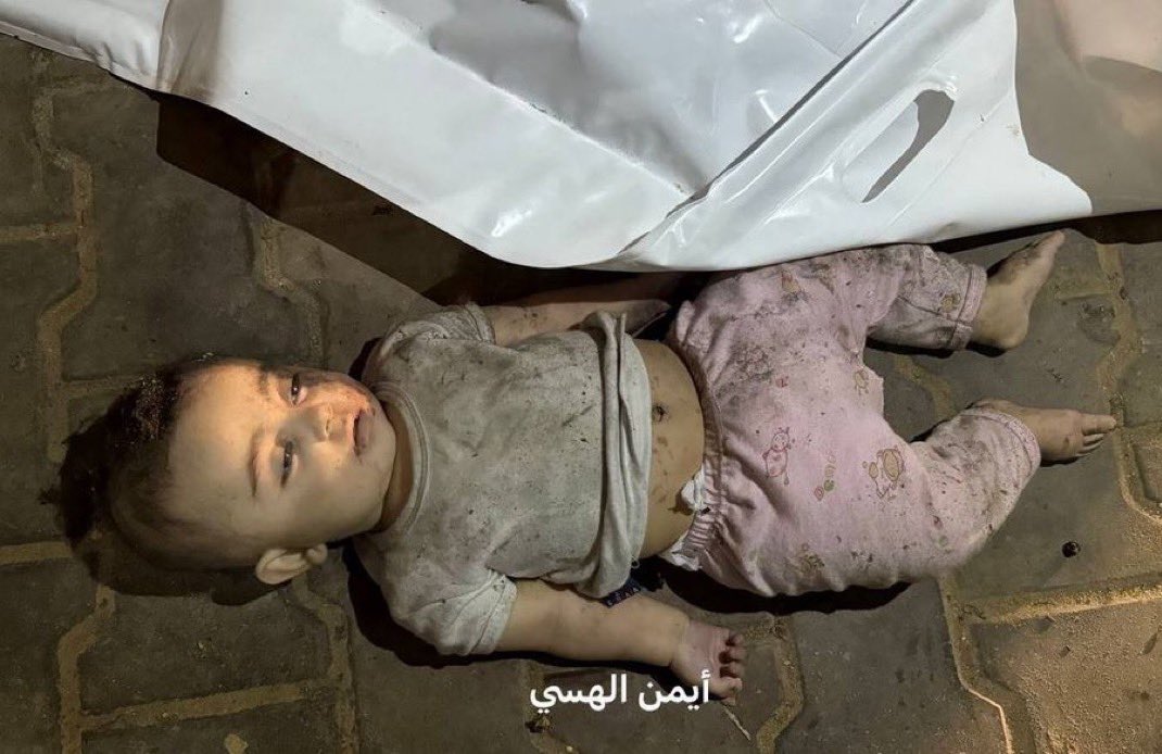 A little boy shaking in shock.
Hind Rajab’s bullet-riddled car.
A baby in rainbow onesie.
A charred baby killed in their father’s arms, wrapped together in a blanket.
Khaled Nabhan kissing his granddaughter’s eyes.

A baby in pink pants.

Added to the horrors we’ll never forget.