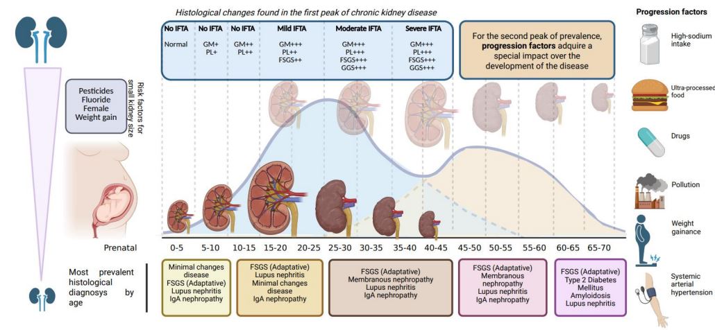 Now online in <a href="/NDTsocial/">NDT</a>

Multifactorial chronic kidney disease   

🧐 Life is long and our kidneys have to take many hits, hence, adult CKD is usually multifactorial as is atherosclerosis or dementia. RF control is key and RF vary across world regions

▶️academic.oup.com/ndt/article-ab…