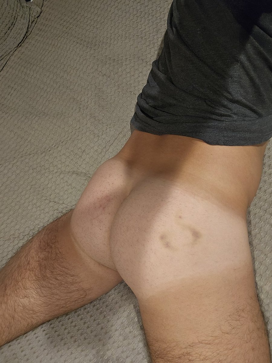 When the Dom top bites too hard 🫡