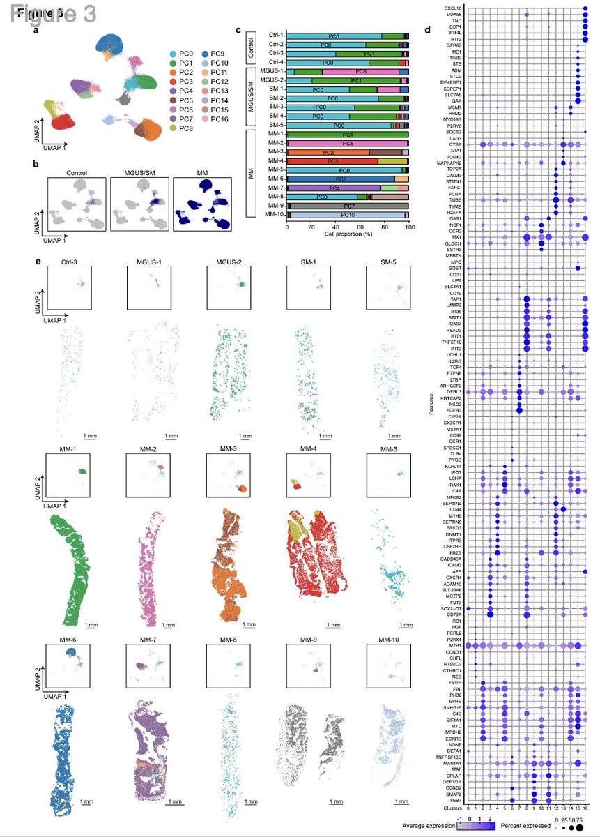 Myeloma_Doc's tweet image. #Myeloma Paper of the Day: Profiling architecture of myeloma in human bone marrow biopsies w/ spatial transcriptomics finds spatially restricted subpopulations of PCs & distinct microenvironments that can vary between patients and spatial locations: pubmed.ncbi.nlm.nih.gov/40643106/. #mmsm