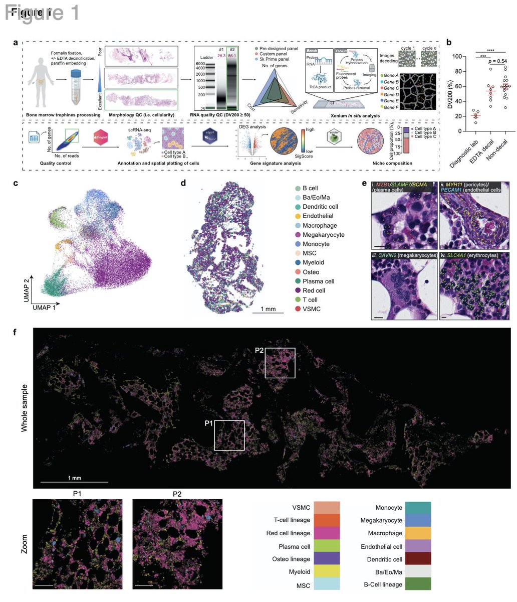 Myeloma_Doc's tweet image. #Myeloma Paper of the Day: Profiling architecture of myeloma in human bone marrow biopsies w/ spatial transcriptomics finds spatially restricted subpopulations of PCs & distinct microenvironments that can vary between patients and spatial locations: pubmed.ncbi.nlm.nih.gov/40643106/. #mmsm