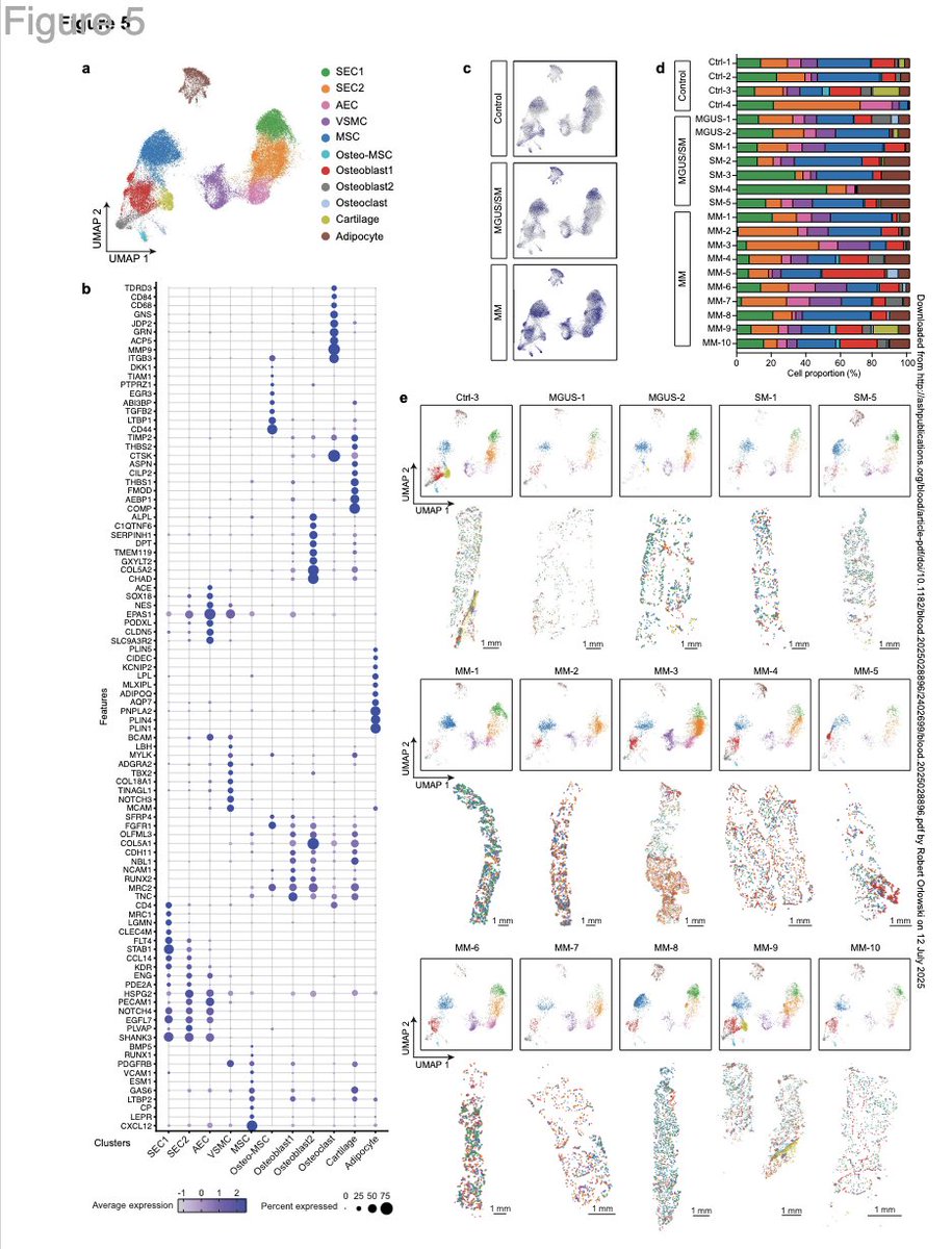 Myeloma_Doc's tweet image. #Myeloma Paper of the Day: Profiling architecture of myeloma in human bone marrow biopsies w/ spatial transcriptomics finds spatially restricted subpopulations of PCs & distinct microenvironments that can vary between patients and spatial locations: pubmed.ncbi.nlm.nih.gov/40643106/. #mmsm