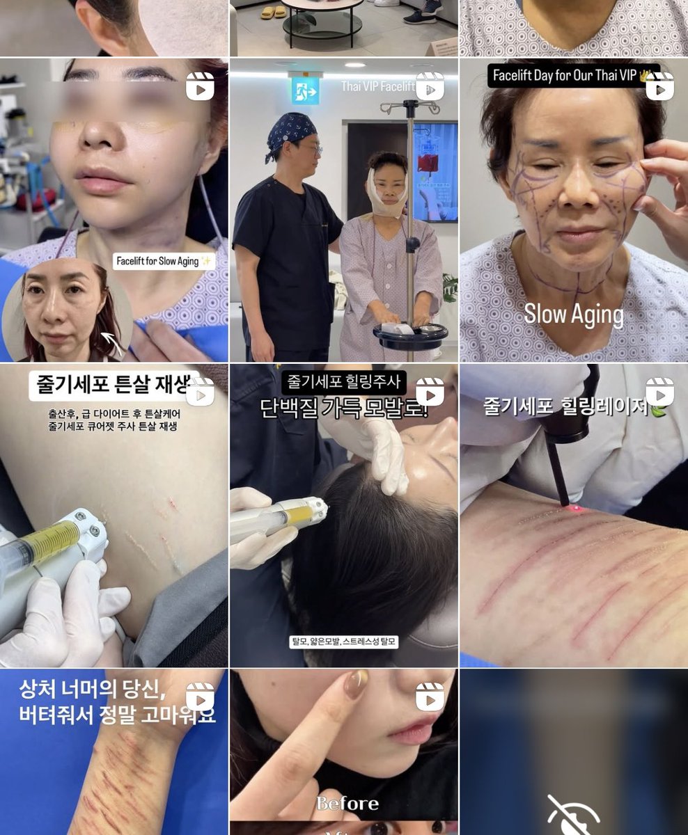 조아성형외과의원
傷跡治療、肌注射上手い
日本アカウントなし
めも