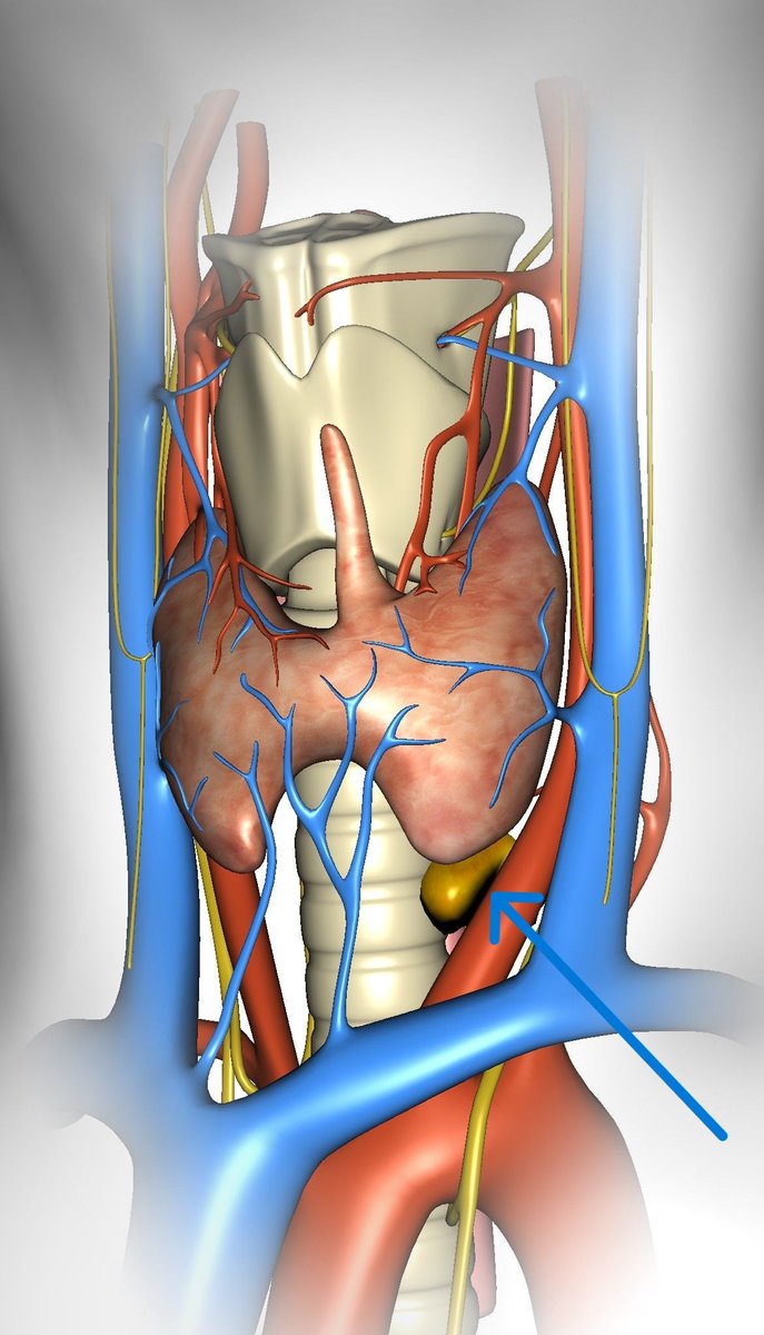 TheAAES's tweet image. A diagram of the thyroid gland is rotated to show the very enlarged left inferior parathyroid gland. Use this free app (Thyroid Navigator) to explore the anatomy! #CheckYourCalcium #PAM2025 @TheAACE @ParaTroupers1 @TheEndoSociety
