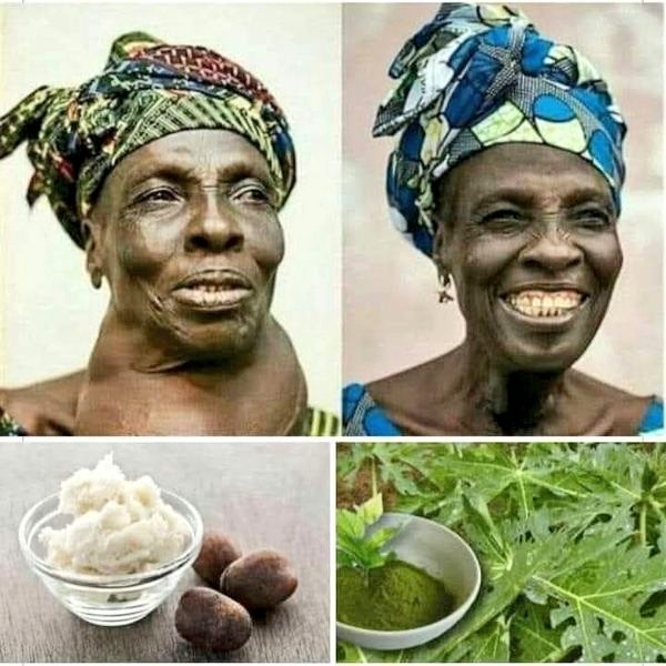 🚨 HERE’S HOW TO TREAT GOITER   (Enlarged Thyroid) 
NATURALLY AND EFFECTIVELY !!!  

TESTED AND APPROVED 🌅  

🚨 INGREDIENTS  
- 200g of papaya leaves powder;  
- 100g of shea butter;  

🚨 PREPARATION  
1) Air-Dry the male papaya leaves for days then blend them to powder  
2)