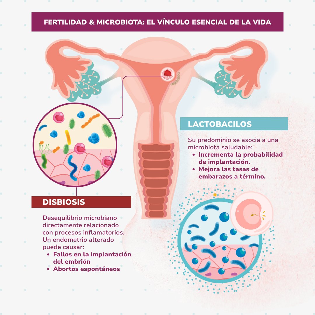 redinfertiles's tweet image. 🧬 ¿Quieres participar?

Está en marcha un ensayo clínico para evaluar Fertibiome, un probiótico oral que ayuda revertir la disbiosis urogenital en la pareja con el fin de mejorar las posibilidades de embarazo.

👉 Dirigido a mujeres o parejas con dificultades para concebir,…