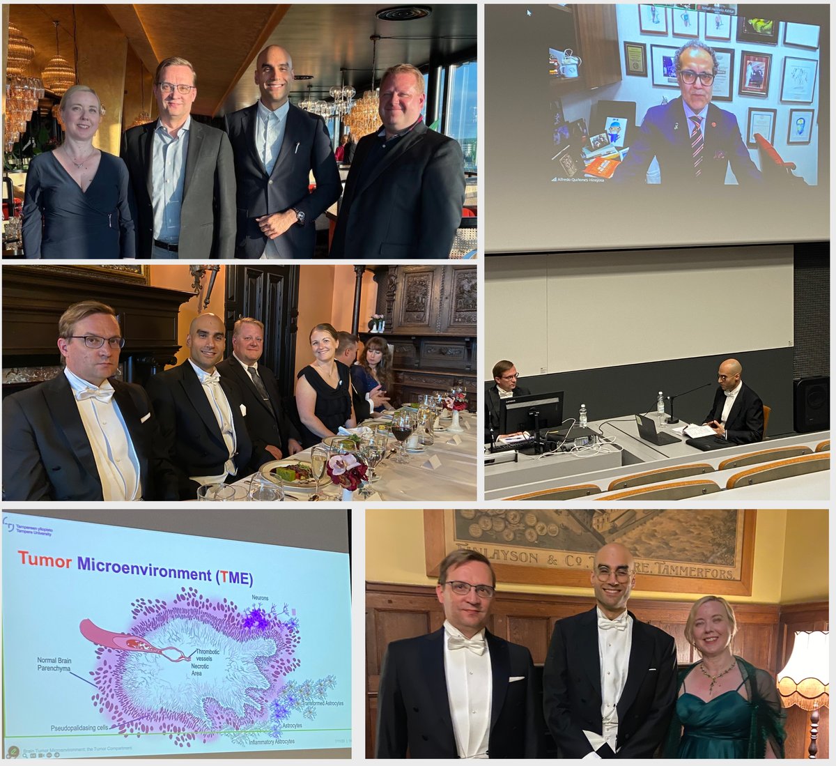 We had a wonderful day yesterday celebrating Ismaïl Hermelo's inspiring PhD defense (thesis entitled From Neoplastic Cells to Non-Canonical Immune Subsets in Human Brain Tumors) and heart-warming karonkka party. 🥰 Congratulations Ismaïl  for this great achievement.!👏 😊
