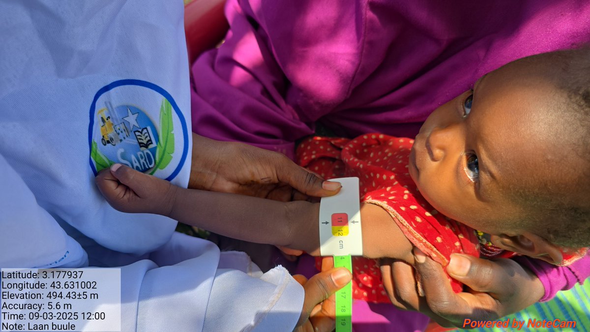 SARD199's tweet image. SARD, with support from @SHF_Somalia, continues to provide critical OTP services in hard-to-reach areas—screening children for malnutrition and providing RUTF and follow-up care. Every child reached is a step toward recovery.
#SARD
#SHF
#NutritionMatters
