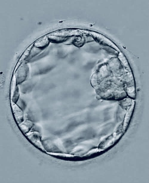 aghoty3's tweet photo. The beauty of Life begins from here. IVF- Blastocyst day 5 ready to be a happy baby in someone’s womb 😙
#infertilitysolution#fertilityissues#blastocyst#ivf#icsi https://t.co/Qw4GL0kK6D