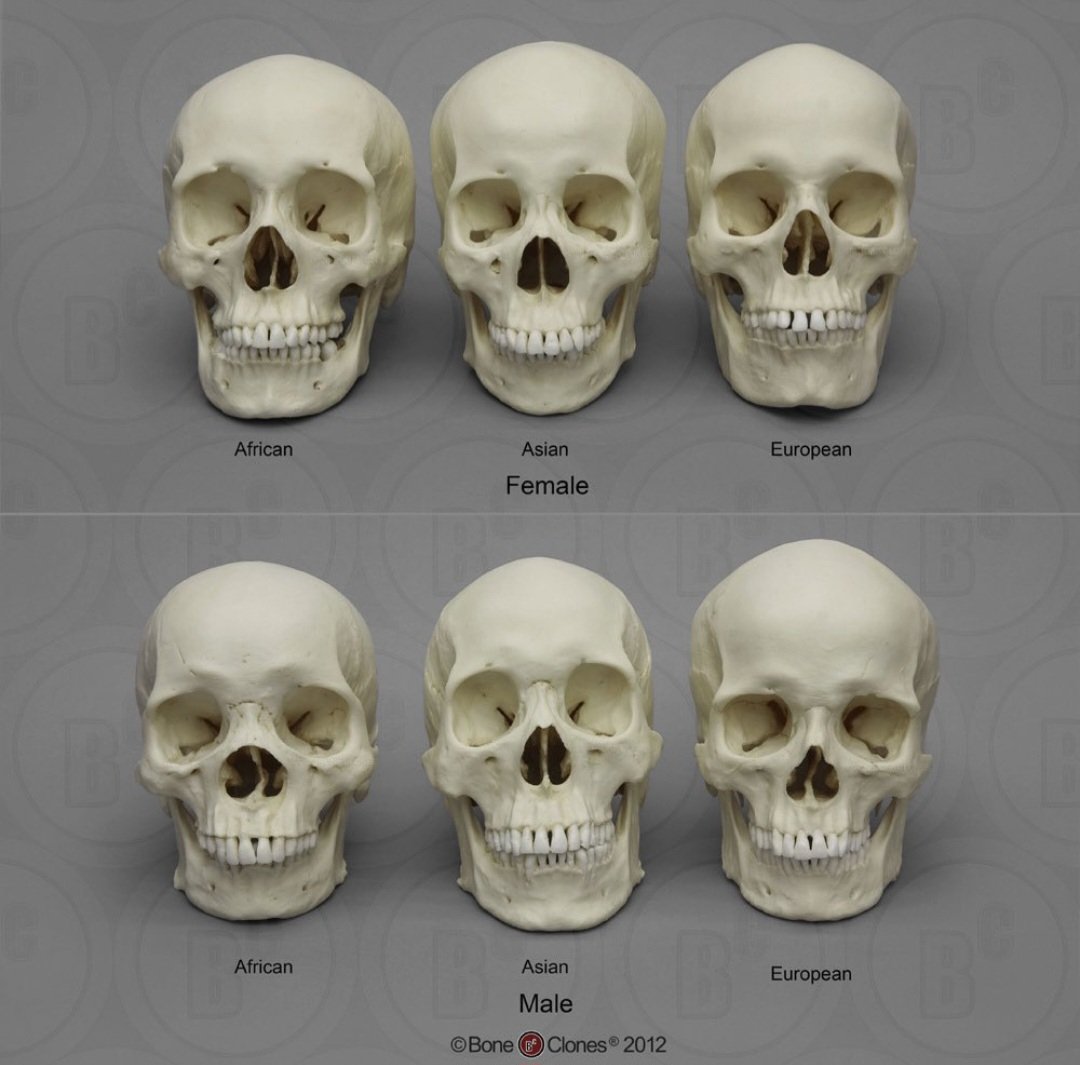 Question for those who believe that "race is a social construct":

How are they able to guess CORRECTLY a race of someone based on skulls only? Could it be because race is a biological reality that you keep rejecting because you hate the implications of that?