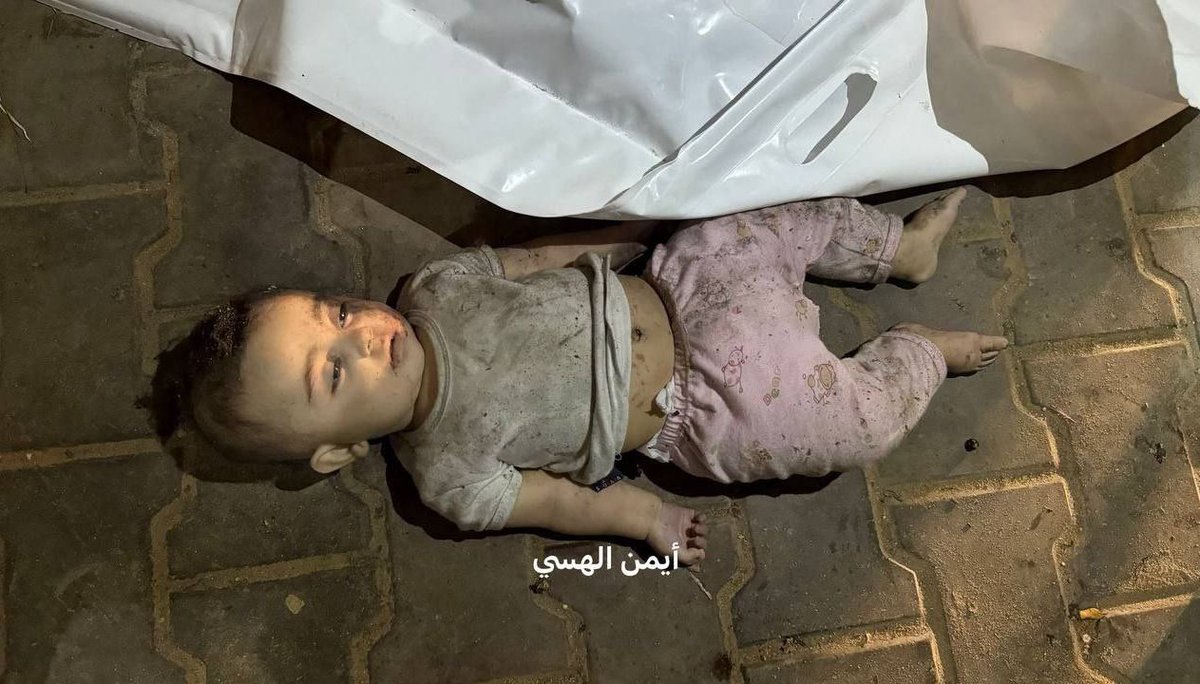 yemenstarvi's tweet image. 🇵🇸💔