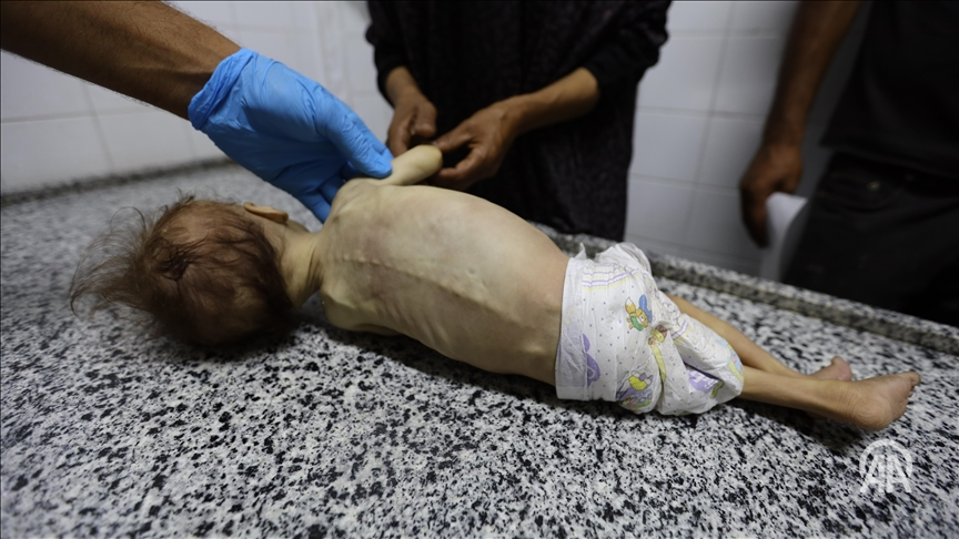 anadoluagency's tweet image. ❝The situation is worse than I've ever seen it before❞
UN World Food Programme warned that the hunger crisis in the Gaza Strip has reached an unprecedented level, with humanitarian efforts crippled by access restrictions v.aa.com.tr/3628618