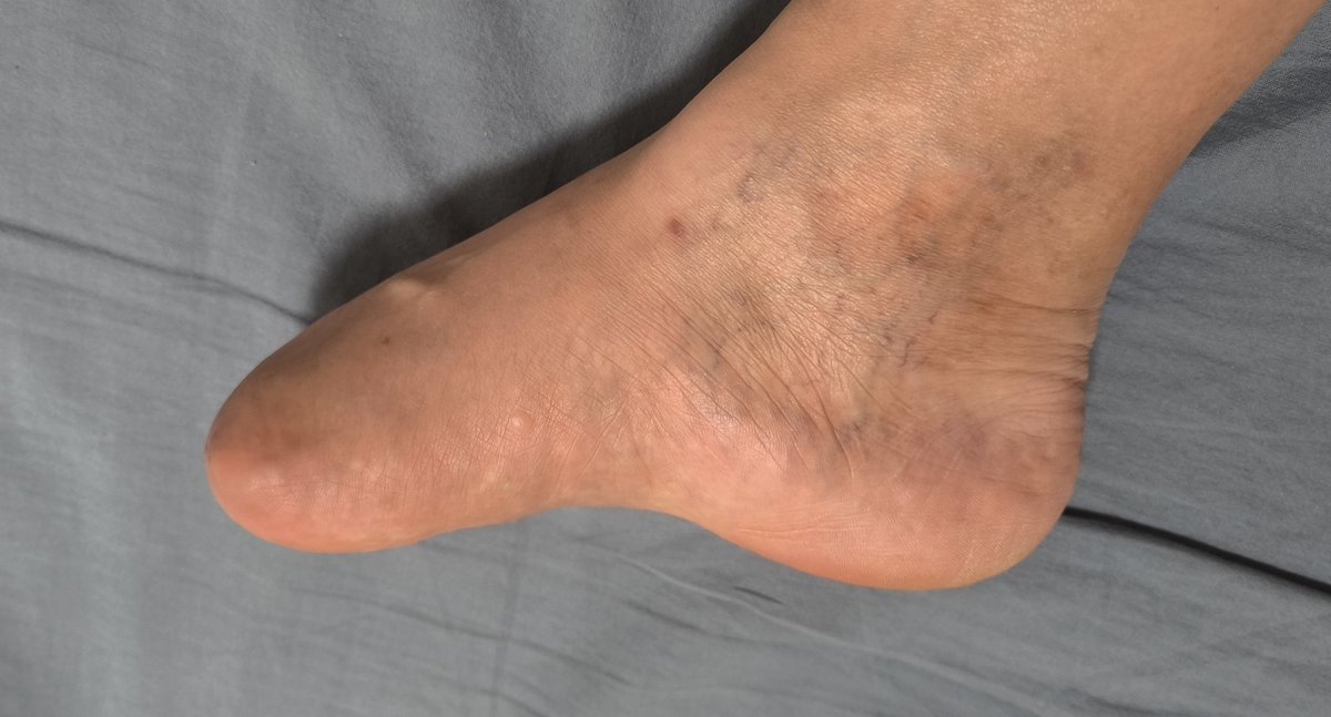 Man with small feet tweet media