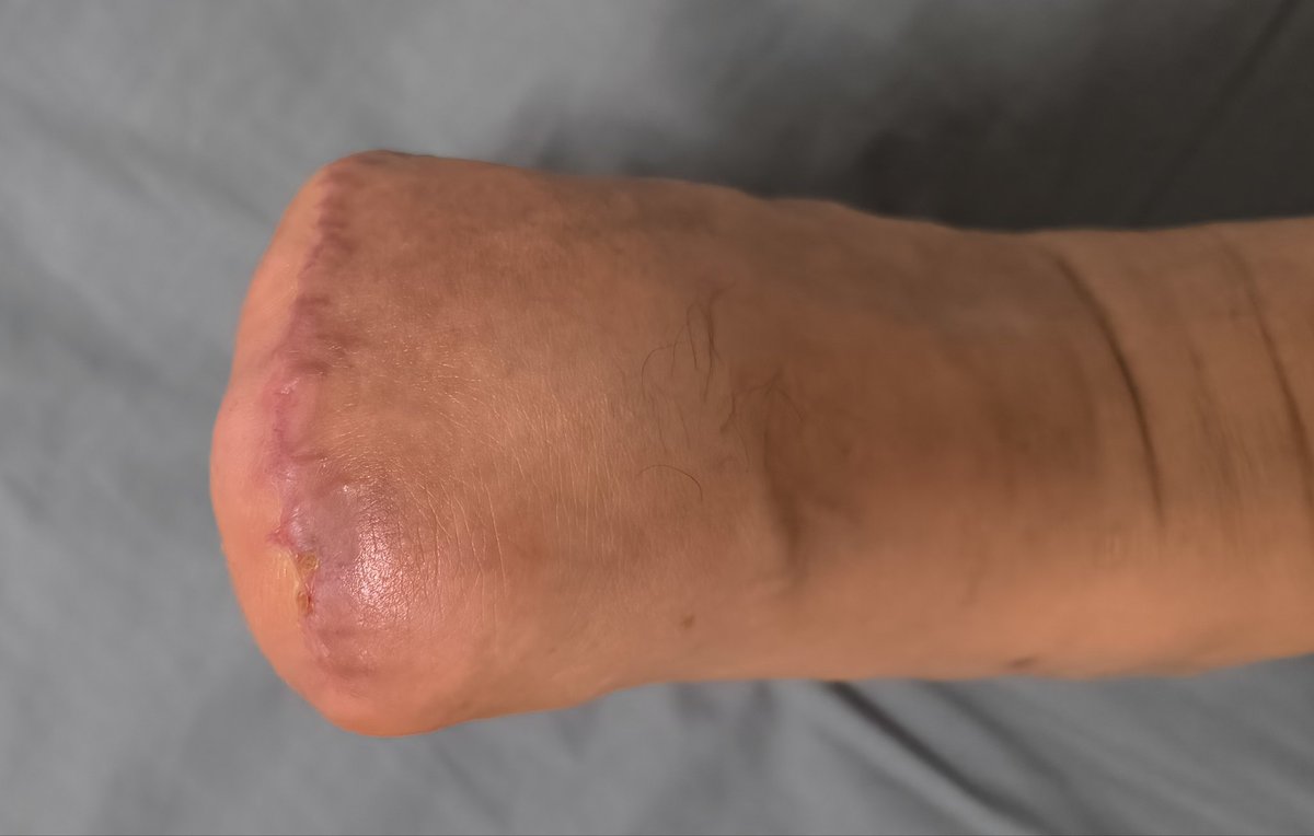 Man with small feet tweet media